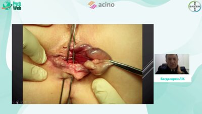 Багдасарян Л.К. - Клинические случаи