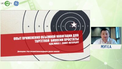 Реут Е.А. - Опыт применения объёмной навигации для таргетной биопсии простаты