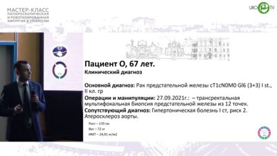 Котов С.В. - Робот-ассистированная радикальная простатэктомия с нервосбережением