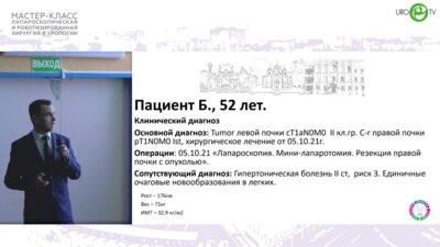 Шпоть Е.В - Робот-ассистированная ретроперитонеоскопическая резекции почки с опухолевым узлом REeNAL 10