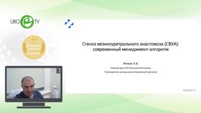 Живов А.В. - Стеноз везикоуретрального анастомоза