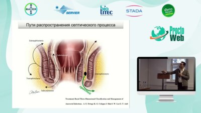 Маркарьян Д.Р. - Абсцессы и свищи прямой кишки