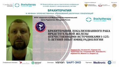 Бирюков В.А. - Брахитерапия локализованного РПЖ отечественными источниками I-125. 5-летний опыт НМИЦ радиологии