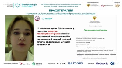 Щукина Е.О. - Высокомощностная брахитерапия локализованного РПЖ. Сравнение различных режимов