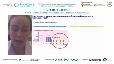 Дубинина А.В. - Современная тактика проведения брахитерапии в лечении местнораспространённого рака шейки матки