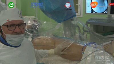 Мартов А.Г., Андронов А.C. - Микроперкутанная нефролитрипсия справа