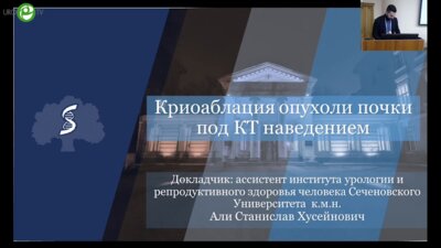 Али С.Х. - Криоаблация опухоли почки под КТ наведением
