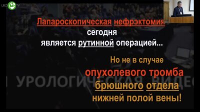 Галлямов Э.А. - Лапароскопическая нефрэктомия