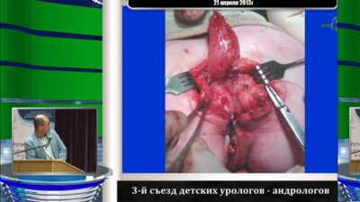 Окулов А.Б. "Значение пластики входа во влагалище при этапном хирургическом лечении"