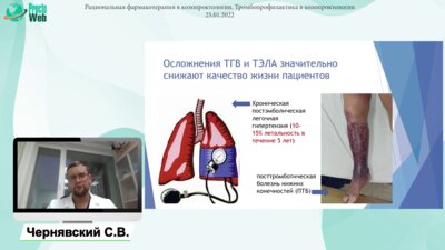 Чернявский С. В. - Тромбопрофилактика в колопроктологии