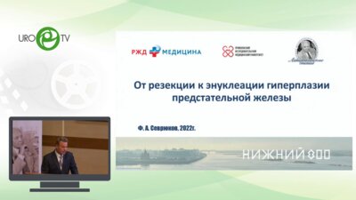 Севрюков Ф.А. - От резекции к энуклеации гиперплазии предстательной железы