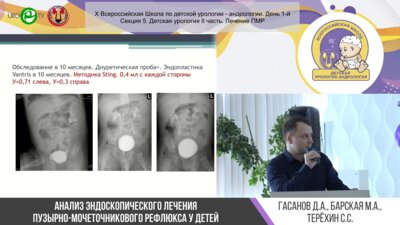 Секция 5. Детская урология II часть. Лечение ПМР