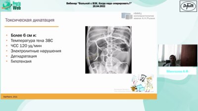 Мингазов А.Ф. - Больной с язвенным колитом. Сложный выбор между колэктомией и терапией