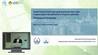Дзитиев В.К. - Анастомотическая уретропластика при стриктурах бульбозного отдела уретры. Операция Хольцова