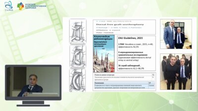 Казихинуров Р.А. - Dorsal free graft urethroplasty