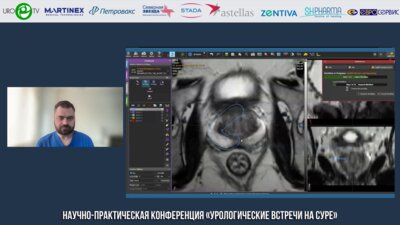 Корякин А.В. - Semi-Life Методика Фьюжн-биопсии предстательной железы