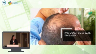 Бабакова Е.Ю. - Эстетическая трансплантация волос