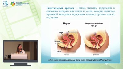 Козуб А.Г. - Урогенитальный пролапс и сексуальная дисфункция