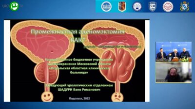 Шадури В.Р. - Промежностная аденомэктомия: кому и зачем?