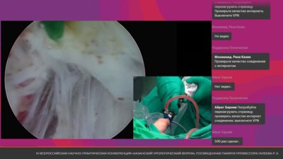 Операция 1. Бурлака О.О. - HoLEP (лазерная гольмиевая энуклеация простаты)