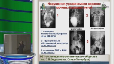 Сарычев С.А. "Хирургическое лечение нарушений резервуарной функции мочевого пузыря у детей с миелодисплазией"
