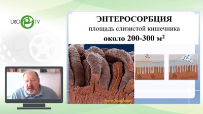 Евстигнеев О.В. - Современная энтеросорбция в патогенетическом лечении урологических заболеваний