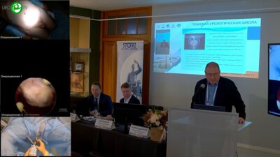 Асфандияров Ф.Р. - ТУР ДГПЖ. Послеоперационные проблемы и их решения