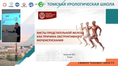 Бощенко В.С. - Кисты предстательной железы как причина обструктивного мочеиспускания