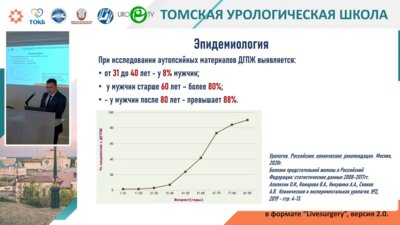 Брагин-Мальцев А.И. - Наш опыт лапароскопической аденомэктомии