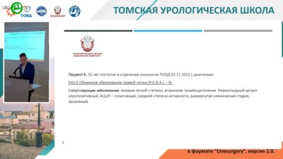 Комаров М.И. - Лапароскопическая резекция почки (видеооперация)