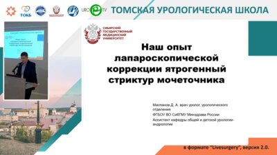 Маспанов Д.А. - Наш опыт лапароскопической коррекции ятрогенных стриктур мочеточника