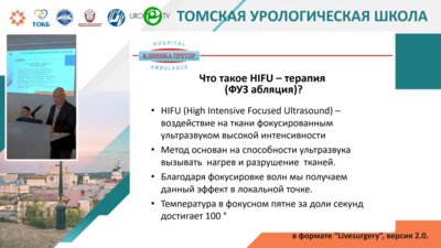 Шкурин М.А. - Возможности применения высокочастотной ультразвуковой абляции в урологической практике