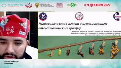 Петросян А.П. - Радиоэмболизация печени с использованием отечественных микросфер