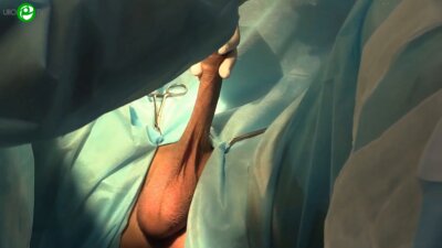 Курбатов Д.Г. - Пластика уретры