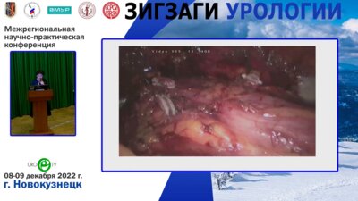 Ильинская Е.В. -  Урологическая круговерть