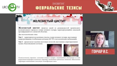 Гончар И.С. - Редкие случаи метаплазии мочевого пузыря