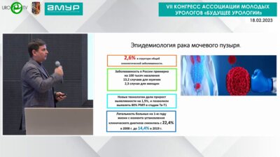 Попов Д.М. - Новое в диагностике и лечении немышечно-инвазивного рака мочевого пузыря