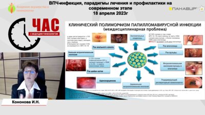 Кононова И.Н. - ВПЧ-инфекция, парадигмы лечения и профилактики на современном этапе
