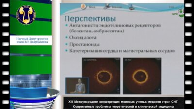 Тойбаева А.К. "Опыт диагностики и лечения легочной гипертензии у детей с врожденными пороками сердца ...."