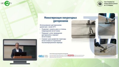 Сытник Д.А. - Эволюция эндоскопического оборудования и лазерных систем для лечения пациентов с МКБ