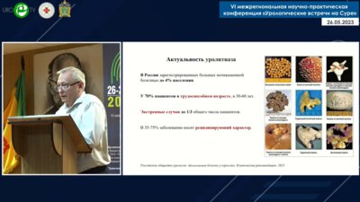 Вдовкин А.В. - Роль МСКТ при решении сложных вопросов литотрипсии