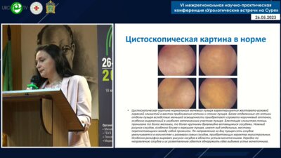 Галкина Н.Г. - Патоморфология хронического цистита