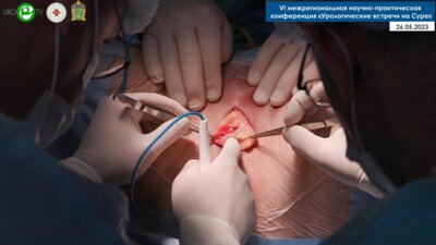 Филимонов В.Б. - Установка мужского слинга I-STOP