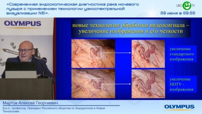 Мартов А.Г. - Новые эндоскопические технологии в диагностике рака мочевого пузыря