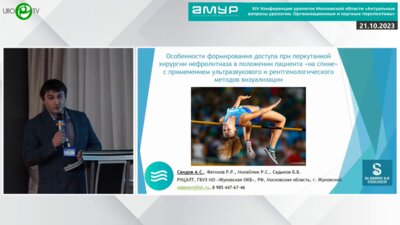 Саидов А.С. - Особенности формирования доступа при перкутанной хирургии нефролитиаза в положении пациента "на спине" с применением УЗИ и рентгена