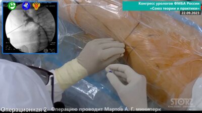 Мартов А.Г. - Миниперк