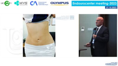 День 1. Зал «САНКТ-ПЕТЕРБУРГ» Сессия «РАСШИРЯЯ ГРАНИЦЫ УРОЛОГИИ»