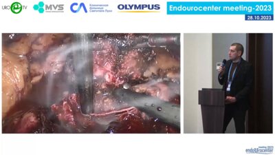 День 2. Зал «САНКТ-ПЕТЕРБУРГ» Сессия «ОНКОУРОЛОГИЯ. РАК ПОЧКИ»