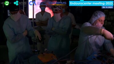 Кочкин А.Д.  - Лапароскопическая простатэктомия. Техника с сохранением ретциева пространства