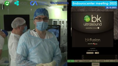 Петов В.С. - Трансректальная FUSION-биопсия свободной рукой на bkFusion